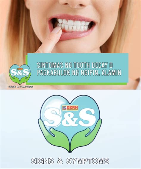 Bulok na Ngipin (Tooth Decay) .